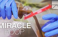 How Fecal Transplants Can Save Lives