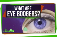 What Are Eye Boogers?