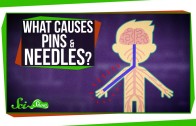 What Causes Pins and Needles?