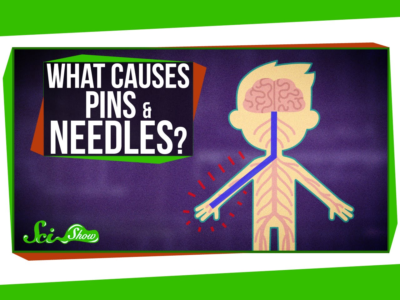 What Causes Pins and Needles? ERA Observer