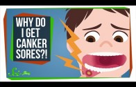 How Do You Get Rid of a Canker Sore?