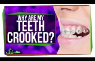 Why Do We Have Such Crooked Teeth?